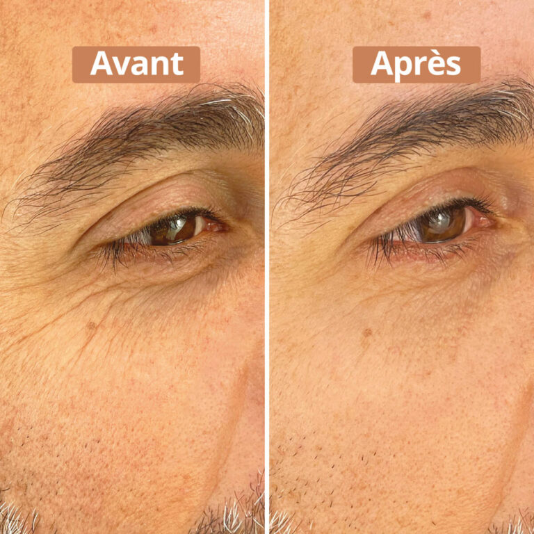 Comme Avant - Sérum contour des yeux - Version 1 – 1 sérum - 10ml