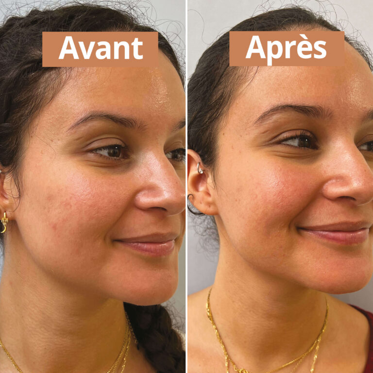 Comme Avant - Routine soin peaux sèches