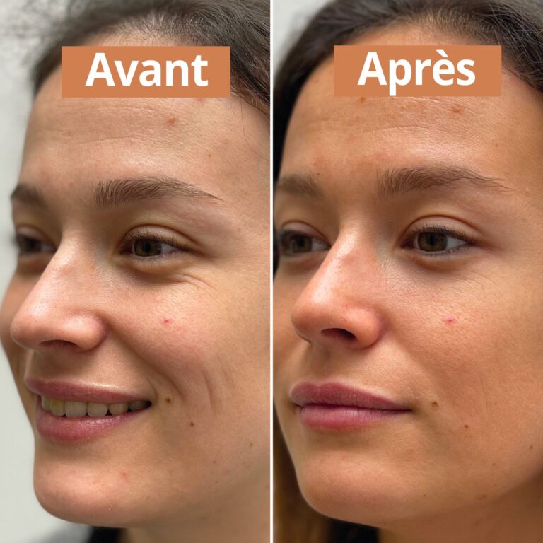 Comme Avant - Sérum autobronzant - Version 1 – 1 sérum - 50ml